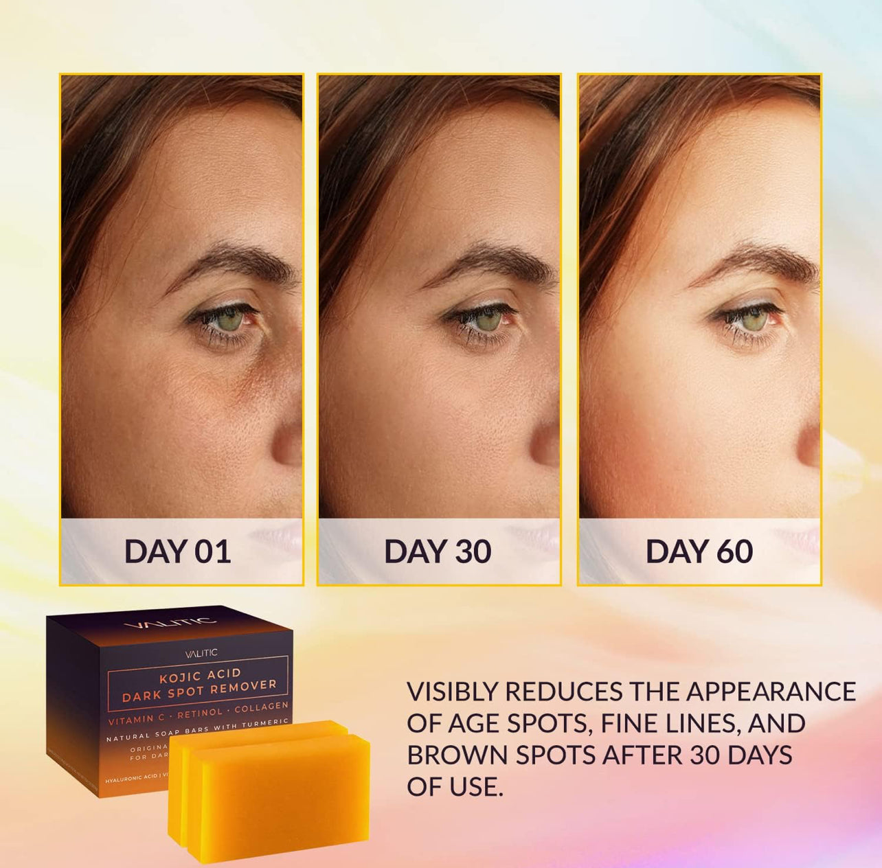 Kojic Acid Dark Spot Soap with Vitamin C, Retinol & Turmeric – Japanese Complex, Hyaluronic Acid & Shea Butter (2 Pack)