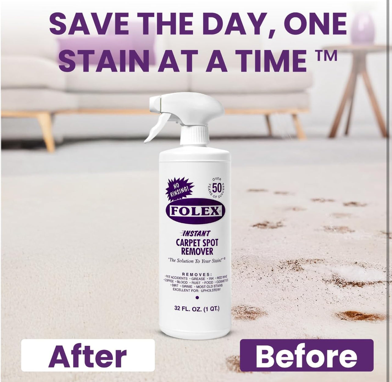 FOLEX Instant Carpet Spot Remover 32 oz – Powerful Stain Remover for Carpets, Upholstery & Rugs – 1 Pack